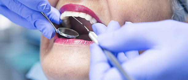 Best Emergency Treatment for Toothache in East Bronson, FL