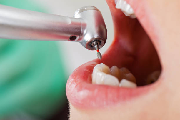 Best Walk-In Emergency Dentist in East Bronson, FL
